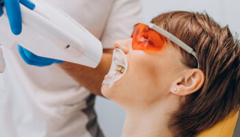 How Teeth Whitening Laser Treatments Enhance Your Smile