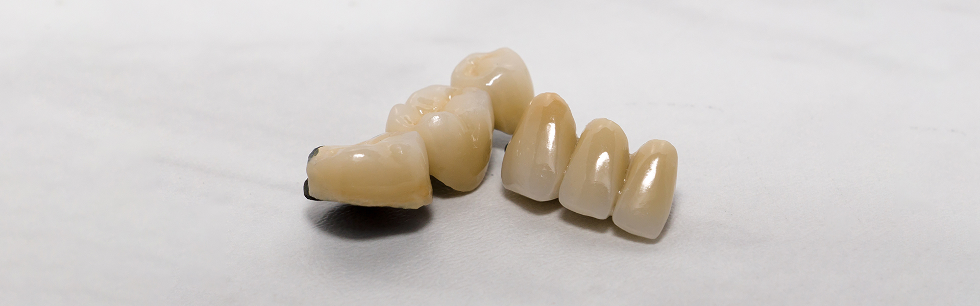 What To Do If Your Dental Crown Gets Damaged?