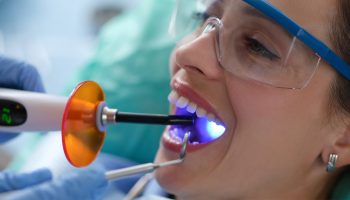 The Upsides of Dental Bonding Over Other Cosmetic Dental Procedures